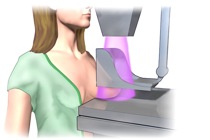 طرق تشخيص سرطان الثدي