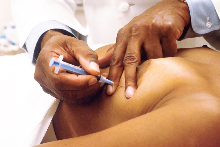 خزعة الثدي بالإبرة