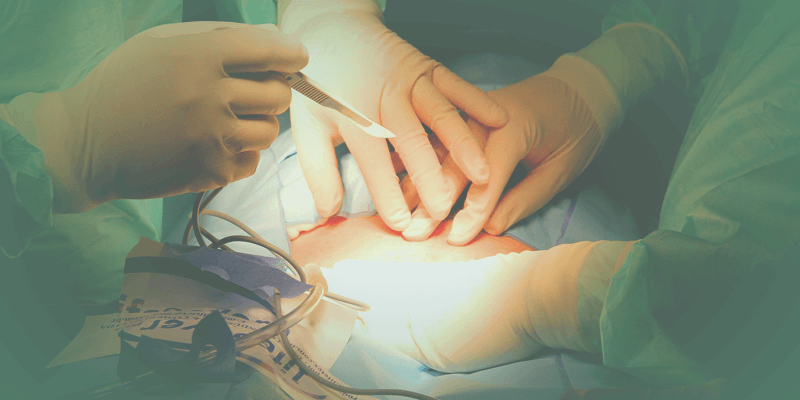 مضاعفات ومشاكل الجروح بعد العمليات