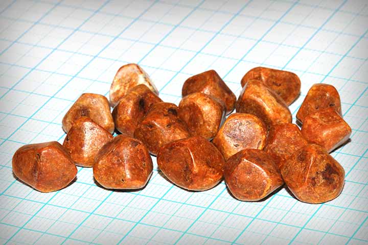 اسباب حصى المرارة