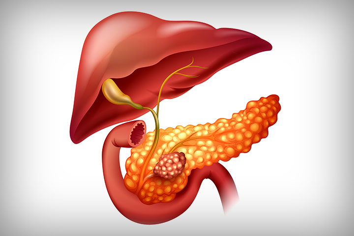 مضاعفات ومشاكل حصى المرارة