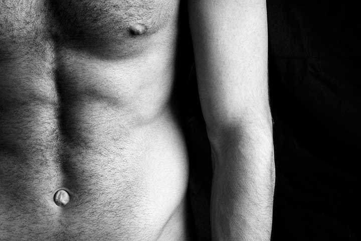 علاج فتق السرة