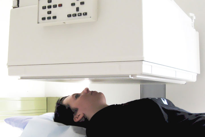 اليود المشع في علاج الغدة الدرقية