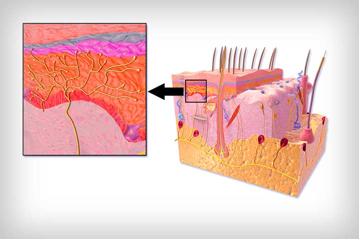 انقر للتكبير تحدث وخزات في جرح العملية بسبب إصابة الأعصاب الصغيرة تحت الجلد