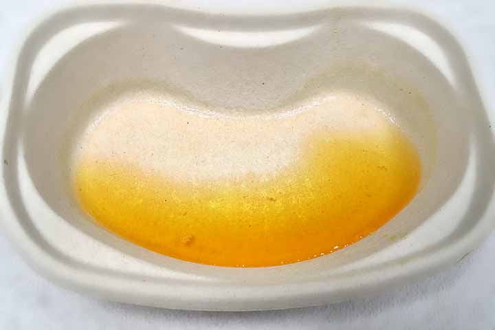 سوائل مصلية في جرح العملية