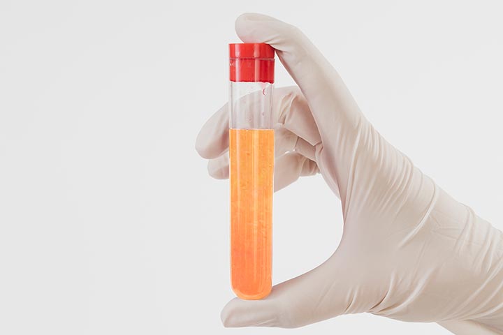 تورم الجرح بسبب مفرزات دهنية