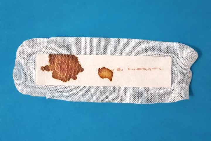 دم بكمية قليلة على الضمادة بعد العملية الجراحية